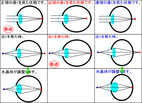 近視・正視・遠視