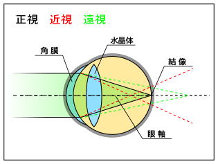 近視・正視・遠視