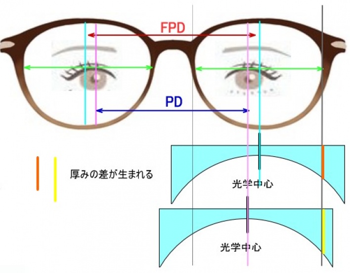 強度近視を薄くするコツ