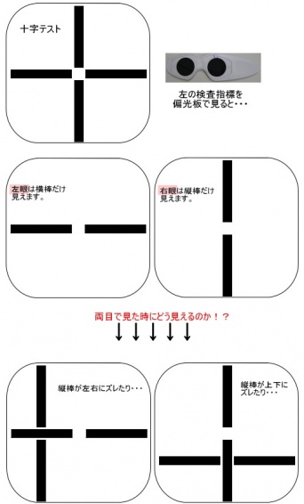 十字テスト