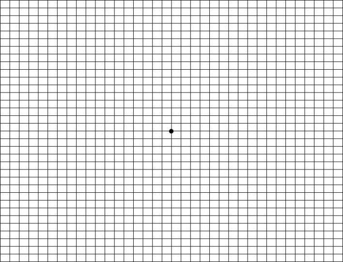 遠近両用メガネチェックシート